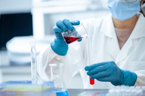 Stool Reducing Substances – MedTech Services Laboratory
